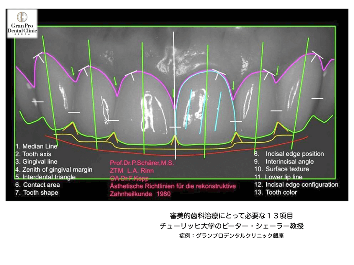 審美的歯科治療にとって必要な13項目