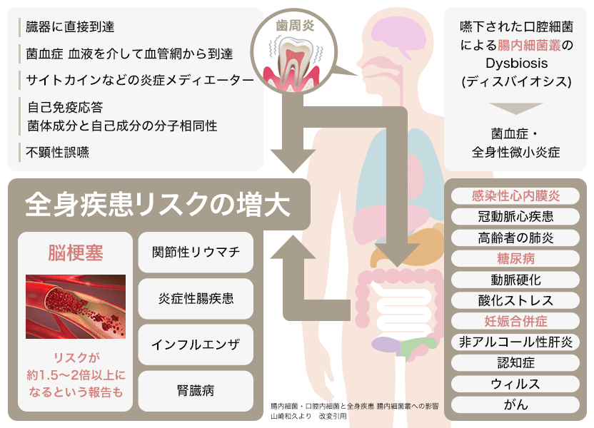 歯周病の全身への影響