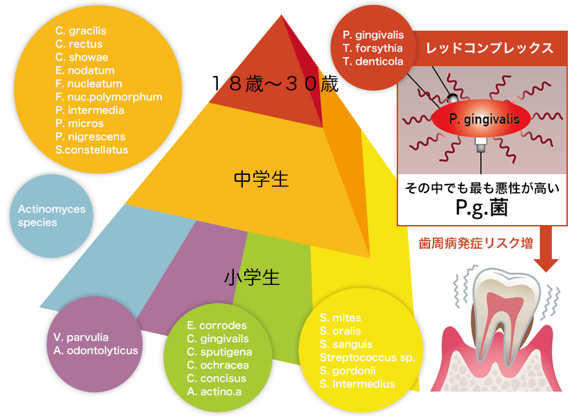 歯周病検査・歯周外科治療｜グランプロデンタルクリニック銀座