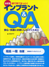 決定版 絵で見てなっとくインプラントQ&A