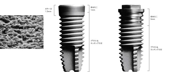 Re（GCインプラントシステム）