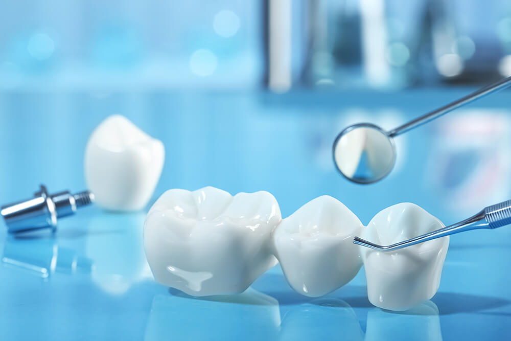 仮歯の重要性について